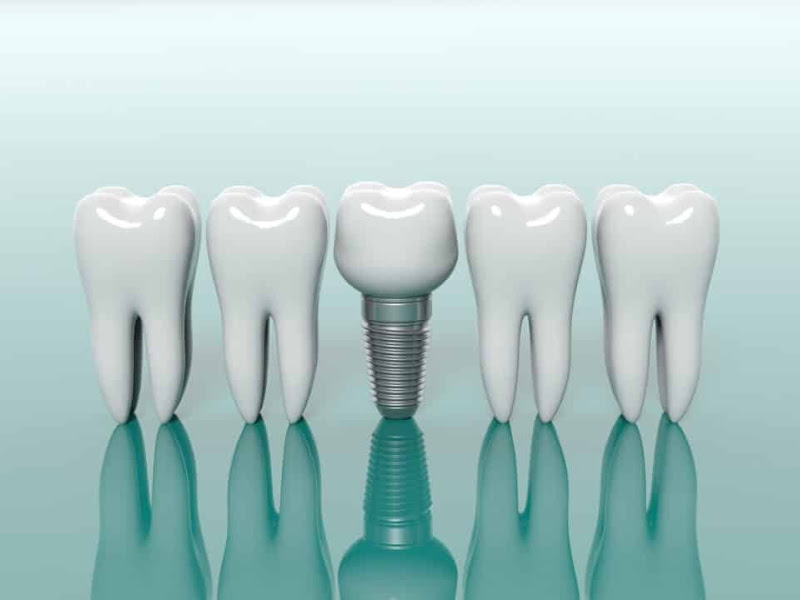 Foto 3 de Dra. Marcela Granato | Dentista | Tratamento de canal | Endodontia