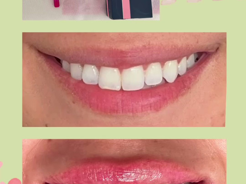 Foto 4 de Dra. Marcela Granato | Dentista | Tratamento de canal | Endodontia