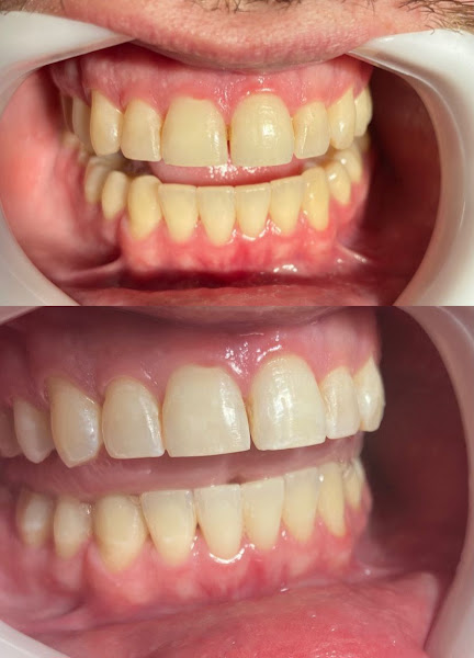 Foto 3 de Dra Marcela M Machado - Cirurgiã Dentista