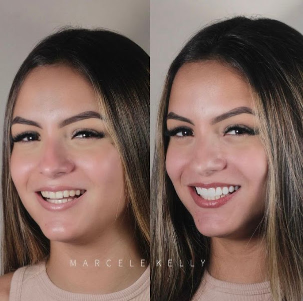 Dra. Marcele Kelly