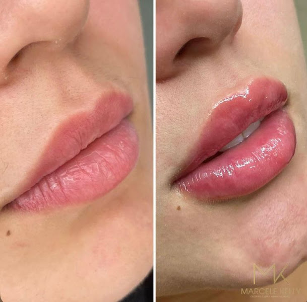 Foto 2 de Dra. Marcele Kelly