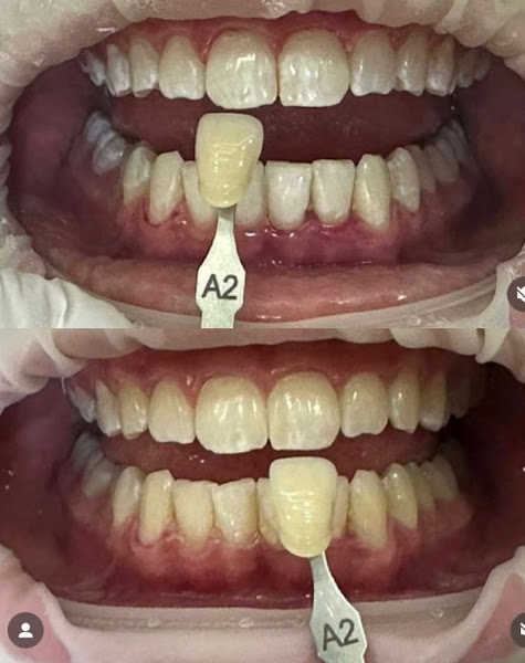 Foto 3 de Dra. Marcella Godas | Odontologia e Harmonização facial