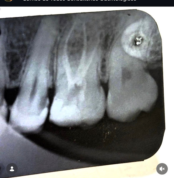 Foto 2 de Dra Marcella Santoro | Tratamento De Canal Barbacena