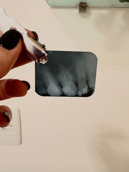 Foto 3 de Dra Marcella Santoro | Tratamento De Canal Barbacena