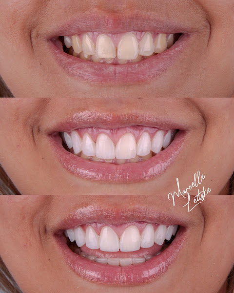 Foto 3 de Dra. Marcelle Leitzke