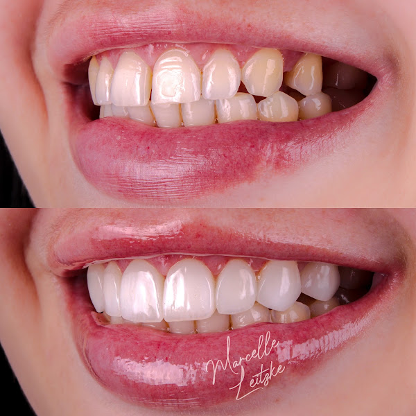 Foto 4 de Dra. Marcelle Leitzke