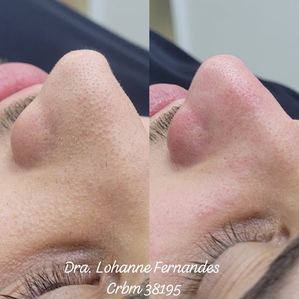 Foto 2 de Dra Marcia Filgueiras - Centro de Estética Avançada & Laser