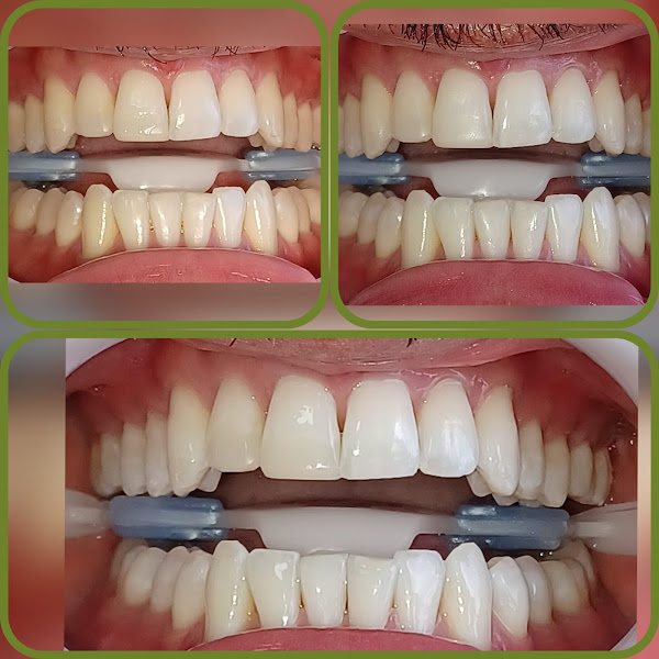 Foto 3 de Dra Márcia Navarro - Ortodontista Salvador