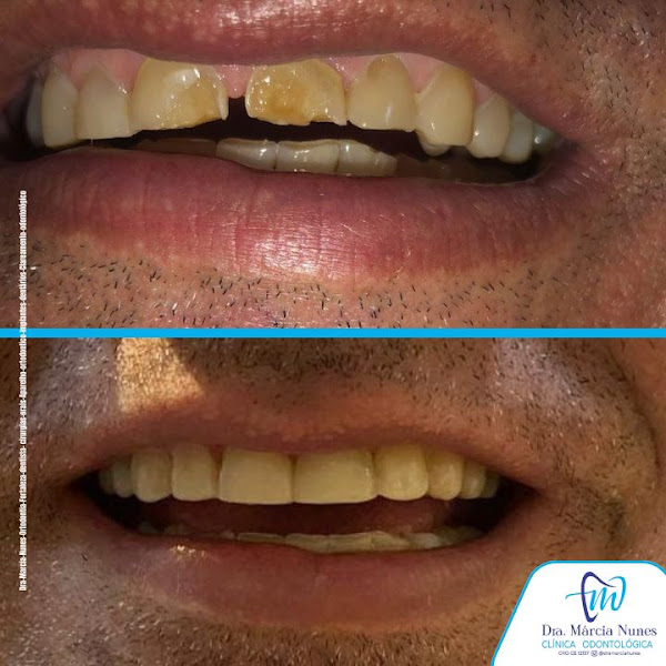 Foto 3 de DRA. MARCIA NUNES I DENTISTA I ORTONDONTIA I IMPLANTE DENTARIO I PARANGABA - FORTALEZA