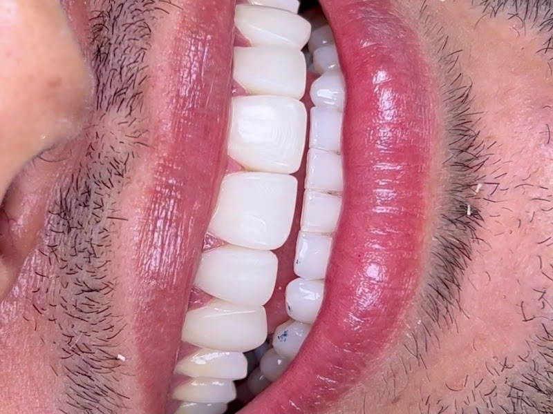 Foto 8 de DRA. MARCIA NUNES I DENTISTA I ORTONDONTIA I IMPLANTE DENTARIO I PARANGABA - FORTALEZA