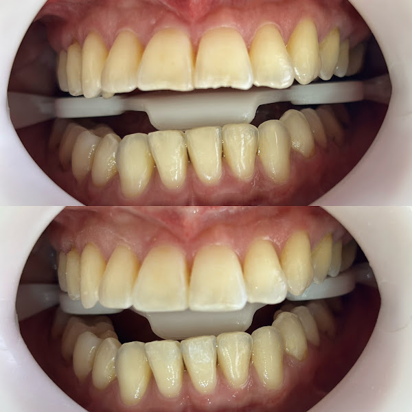 Foto 2 de Dra. Maria Angelina | Dentista em Curitiba