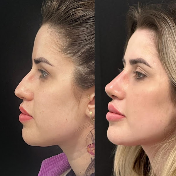 Foto 3 de Dra. Maria Carla - Harmonização Facial e Corporal