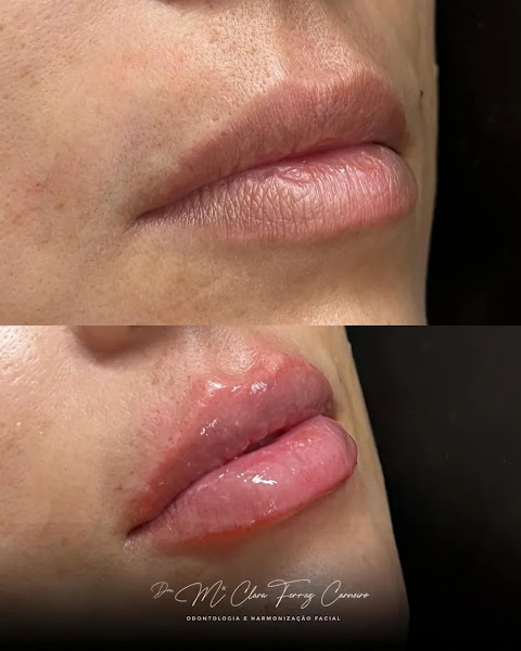 Foto 3 de Dra. Maria Clara Ferraz Carneiro - Cirurgião Dentista