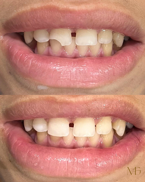 Foto 3 de Dra. Maria Clara Girão - Odontologia Estética & Restauradora