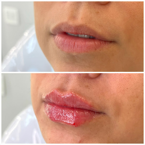 Foto 3 de Dra. Maria Claudia Clínica de Harmonização Orofacial