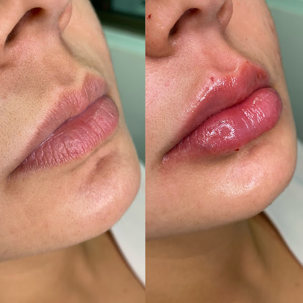 Foto 3 de Dra. Maria Claudia Clínica de Harmonização Orofacial