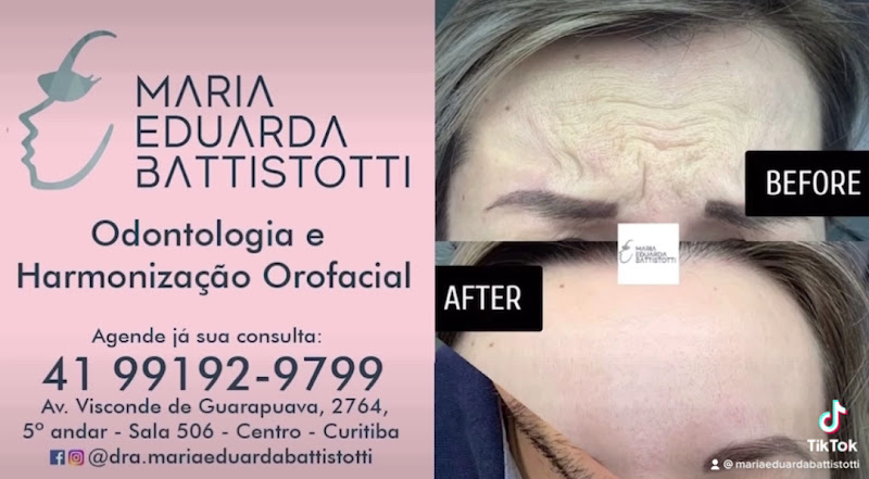 Foto 3 de Dra. Maria Eduarda Battistotti - Odontologia e Harmonização Orofacial