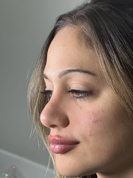 Foto 3 de Dra Maria Eduarda Lima • odontologia estética