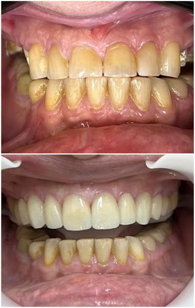 Foto 2 de Dra Maria Eugenia - Dentista Urgências e Emergencias