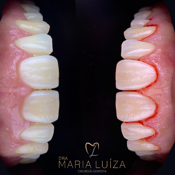Foto 2 de Dra Maria Luíza - Odontologia Especializada