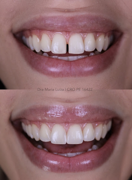 Foto 3 de Dra Maria Luíza - Odontologia Especializada