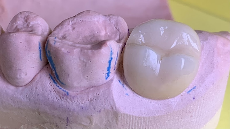 Foto 4 de Dra Maria Luíza - Odontologia Especializada