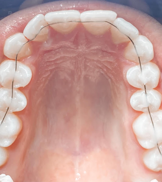 Foto 2 de Dra. Maria Teresa Lima- Ortodontista