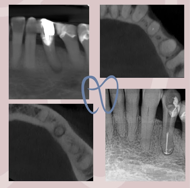 Foto 3 de Dra. Maria Tereza Andrade Aragão - Consultório Odontológico - Endodontia / Canal com Microscópio