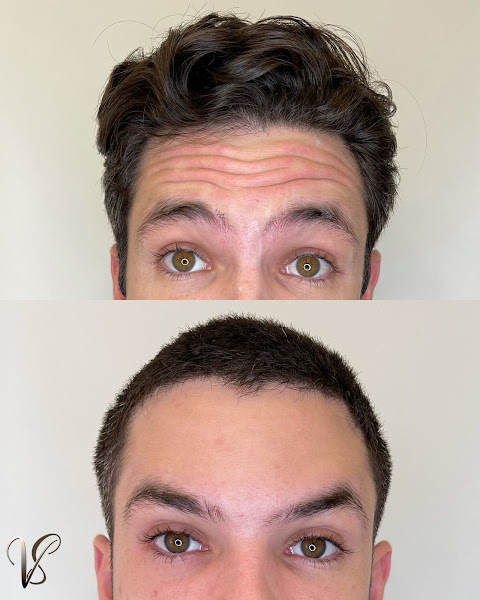 Foto 3 de Dra. Maria Vilma Sobreira - Harmonização Facial, Botox, Lifting e Estética Avançada em Fortaleza-CE