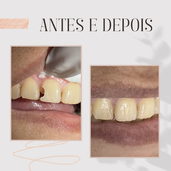 Foto 3 de Dra Maria Vitória Alves Azevedo - Dentista
