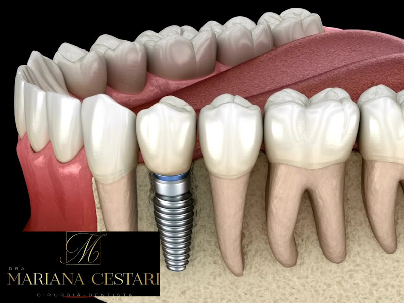 Foto 4 de Dra Mariana Cestari |Dentista 24h | Av Paulista