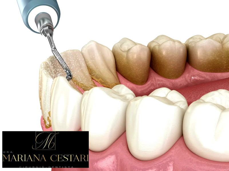 Foto 5 de Dra Mariana Cestari |Dentista 24h | Av Paulista