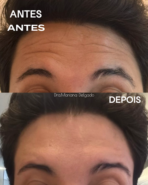 Foto 3 de Dra. Mariana Delgado – Harmonização Facial / Estética / Dentista - São José dos Campos
