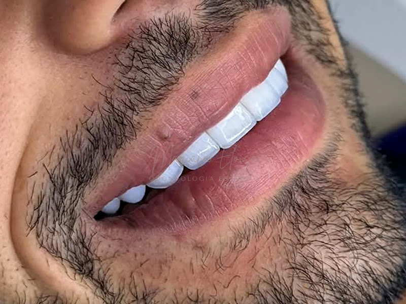 Foto de Dra. Mariana Eloisa | Facetas em Resina