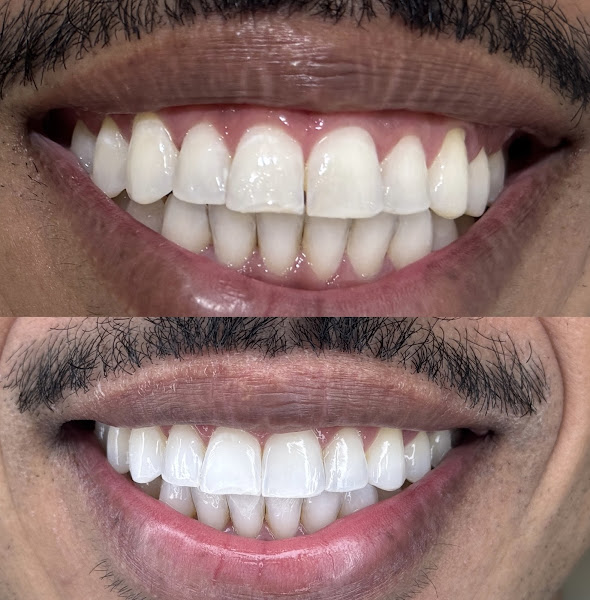 Foto 2 de Dra Mariana Pimenta Dentista - Martins Clinic