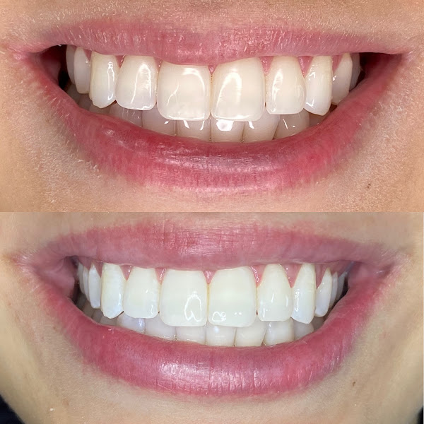 Foto 3 de Dra Mariana Pimenta Dentista - Martins Clinic