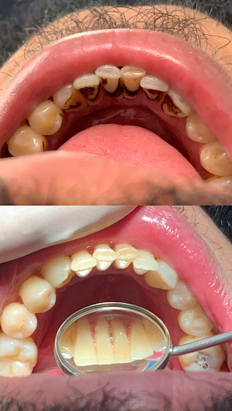 Foto 2 de Dra. Mariana Ribeiro | Dentista Jundiai
