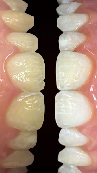 Foto 3 de Dra. Mariana Santos | Odontologia e Harmonização Orofacial