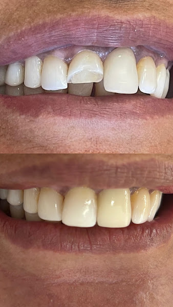 Foto 3 de Dra Mariana Valério Silva - Dentista Maringá