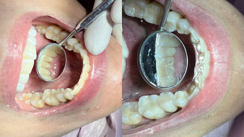 Foto 2 de Dra Mariana Zonzini | Dentista em Pindamonhangaba