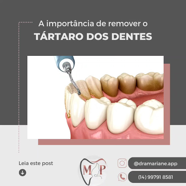 Foto 3 de Dra. Mariane (Dentista Bauru) | SouSmile | Harmonização Orofacial| Odontopediatria