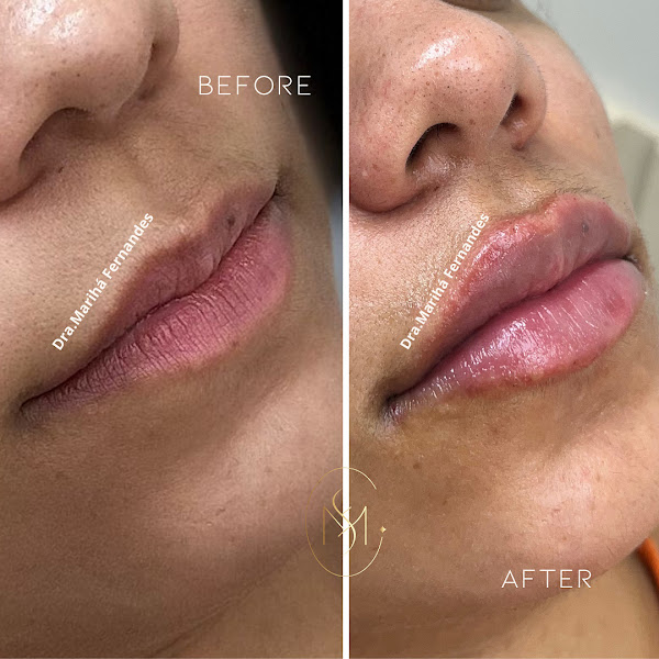 Foto 3 de Dra.Mariha Fernandes Odontologia Estética e Harmonização orofacial