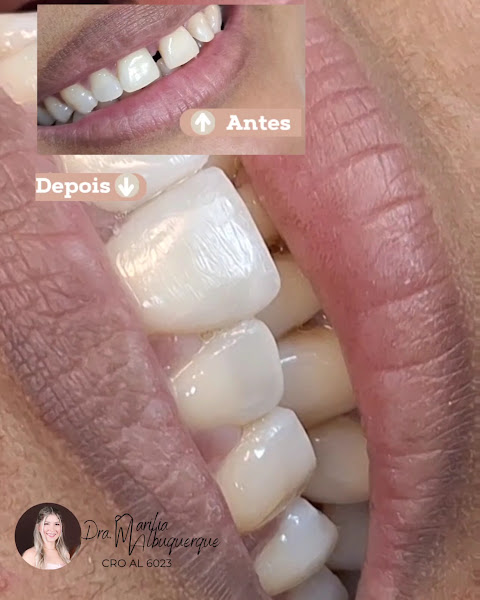 Foto 3 de Dra. Marilia Albuquerque Barbosa (Cirurgiã Dentista)