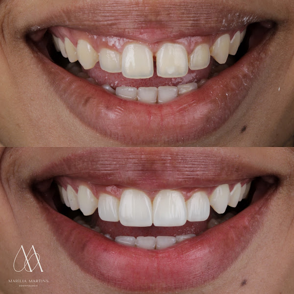 Foto 3 de Dra. Marília Martins | Odontologia