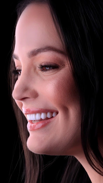 Foto 3 de Dra. Marina Amarante Lente de Contato Dental