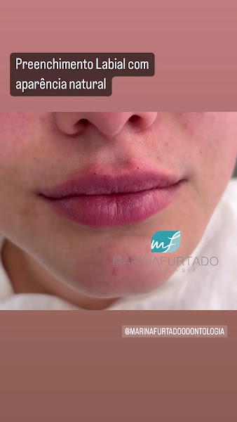 Foto 4 de Dra. Marina F. Furtado - Odontologia Especializada