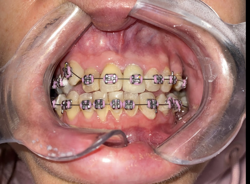 Foto 2 de Dra Marina Longoni Ortodontia