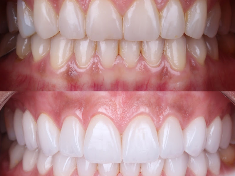 Foto 6 de Dra Marina Marone - Clínica Brooklin de Odontologia