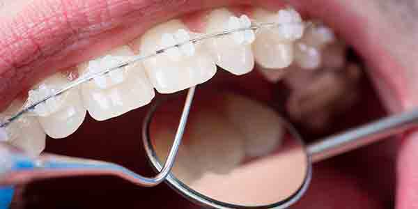 Foto 2 de Dra. Marina Neves - PEDREIRA