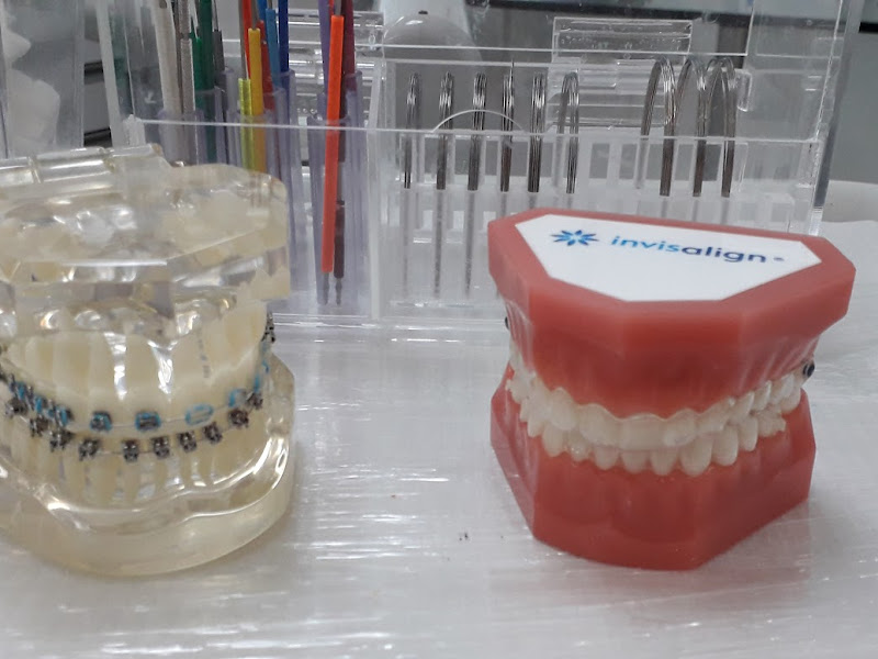 Foto 8 de Dra. Marjorie Almeida - Ortodontia, Invisalign Doctor, Alinhadores Invisíveis, Clareamento, Estética Bucal